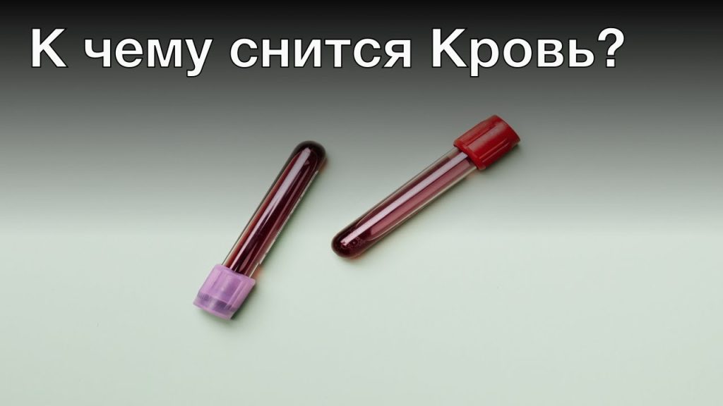 К Чему Снится Кровь: Значение и Толкование Сновидений